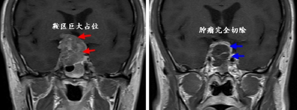 对比图.jpg 对比图.jpg