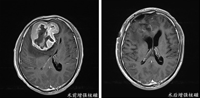 核磁.jpg 核磁.jpg