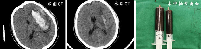 对比图.jpg 对比图.jpg